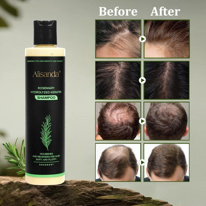 Goldanx® Organic Rosemary Hair Growth Shampoo
